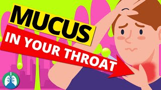 What is a Mucus Retention Cyst of the Sinuses [upl. by Ermanno875]