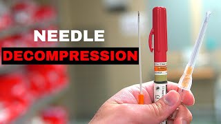 How To Chest Needle Decompression [upl. by Nilek762]