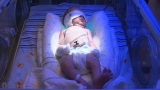 DrugDependent Infants Detox at Tenn NICU [upl. by Nylcsoj]