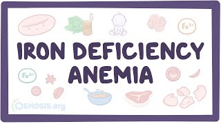 Iron deficiency anemia  an Osmosis Preview [upl. by Assitruc]