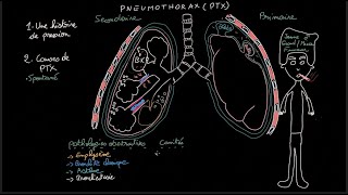 Pneumothorax  Docteur Synapse [upl. by Bannon424]