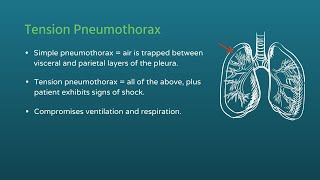 Chest Trauma Tension Pneumothorax [upl. by Blainey]