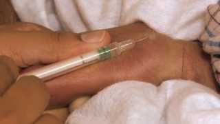 Newborn Care Series Giving an Intradermal Injection [upl. by Barnabas364]