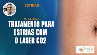 Estrias Aplicação do Laser Co2 Fracionado [upl. by Kathie958]