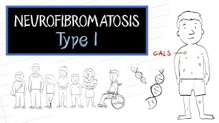 What is Neurofibromatosis Type 1 NF1 [upl. by Larson191]