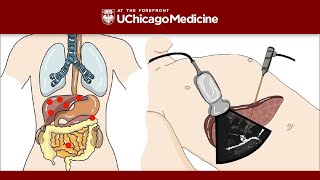 Thyroid UptakeScan  Part 2 [upl. by Ethbun]