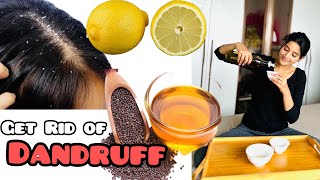 Dandruff Treatment At Home  Hair Care Tips❤️ [upl. by Ettennil30]