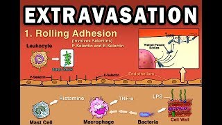 EXTRAVASATION [upl. by Fujio]