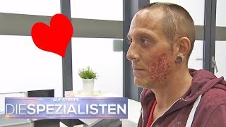 Herzförmige Verbrennung im Gesicht wie ist das passiert  Die Spezialisten  SAT1 TV [upl. by Worthington]