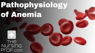 Pathophysiology of Anemia [upl. by Nimesay]