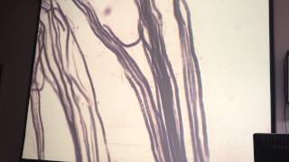 Myelinated nerve fibers [upl. by Ardelia]