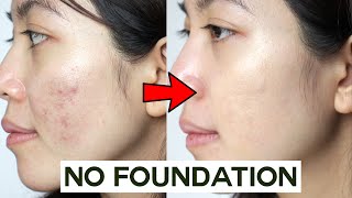 How to Cover Acne amp Blemishes WITHOUT Foundation • easy amp non cakey [upl. by Eibrad981]