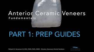 Anterior Ceramic Veneers Part 1 Preparation Guides [upl. by Allyn30]