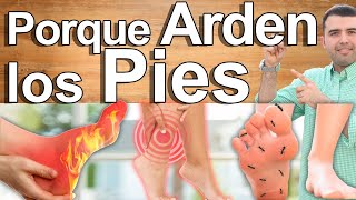 Porqué Me Arden Los Pies  Causas Y Soluciones Para El Ardor Y Dolor En Los Pies [upl. by Maximilian953]