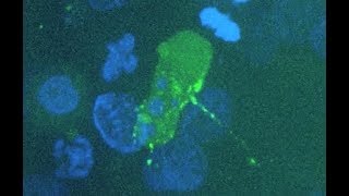 Caught on Camera How HIV Infects Cells [upl. by Delos202]