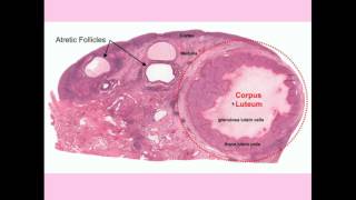 Ovarian Cyst Causes Symptoms and Treatment [upl. by Okoyk]