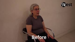 How Speech Therapy helps after Stroke [upl. by Illib898]