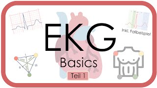 EKG Basics  Step by Step  Grundlagen Einthoven Frequenz Lagetyp PWelle QRS EKGKurs [upl. by Kirk594]